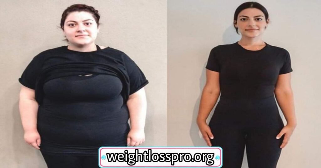 Weight Loss Pro Photo Gallery (Weight Loss Before and After Images)