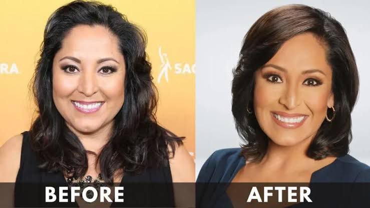 Lynette Romero's Weight Loss